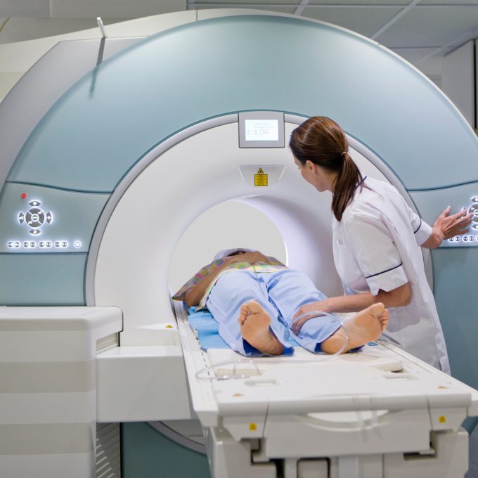 MRI scan MS